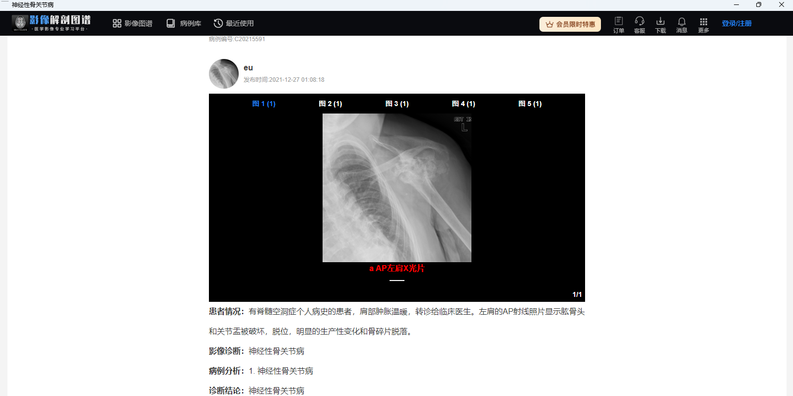 影像解剖图谱64位