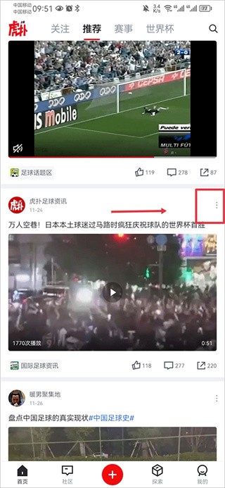 屏蔽内容步骤1