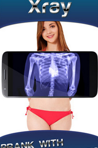 Xray Camera(X光线透视相机)