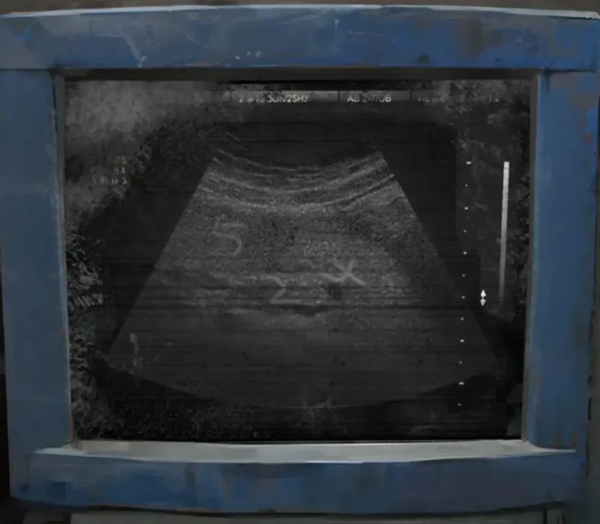 纸嫁衣8千子树游戏